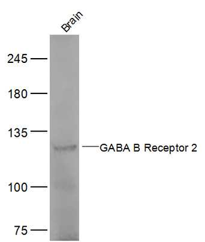 GABBR2 Rabbit Polyclonal Antibody
