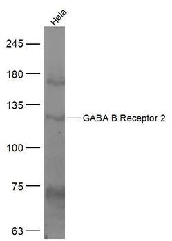 GABBR2 Rabbit Polyclonal Antibody