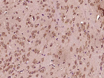 GAD67 Rabbit Polyclonal Antibody