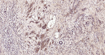 DDIT3 Rabbit Polyclonal Antibody