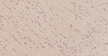 DDIT3 Rabbit Polyclonal Antibody
