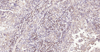 DDIT3 Rabbit Polyclonal Antibody