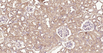 DDIT3 Rabbit Polyclonal Antibody