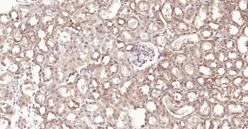 DDIT3 Rabbit Polyclonal Antibody