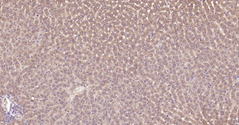 DDIT3 Rabbit Polyclonal Antibody