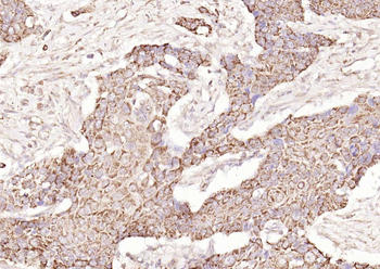 Galectin 3 Rabbit Polyclonal Antibody