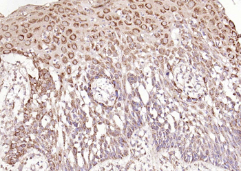 Galectin 3 Rabbit Polyclonal Antibody