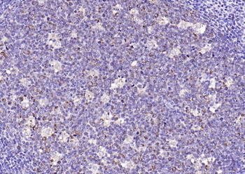 Galectin 3 Rabbit Polyclonal Antibody