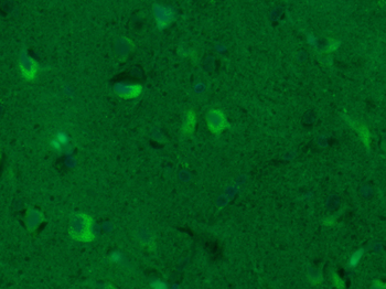 GAP43 Rabbit Polyclonal Antibody