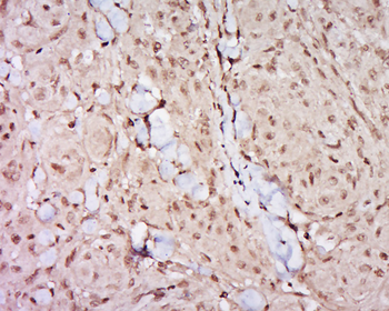 GATA3 Rabbit Polyclonal Antibody