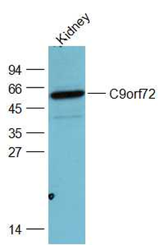 C9orf72 Rabbit Polyclonal Antibody