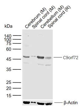 C9orf72 Rabbit Polyclonal Antibody