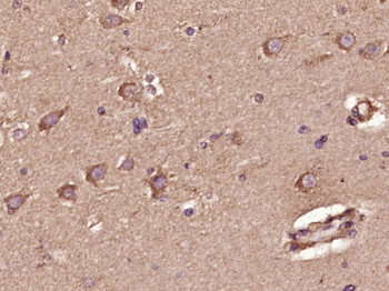 Ceramide glucosyltransferase Rabbit Polyclonal Antibody