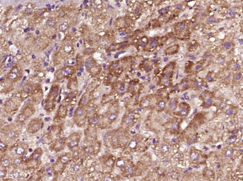 Ceramide glucosyltransferase Rabbit Polyclonal Antibody