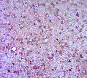 G-CSF/CSF3 Rabbit Polyclonal Antibody