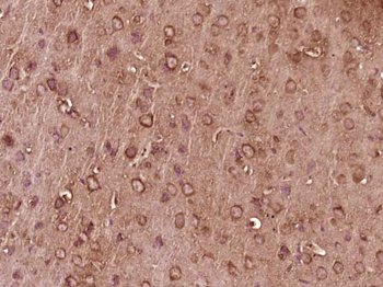 G-CSF/CSF3 Rabbit Polyclonal Antibody