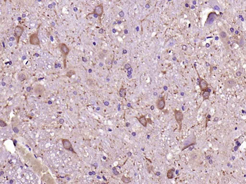 GDNF Rabbit Polyclonal Antibody