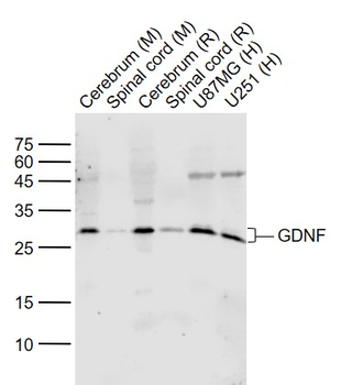 GDNF Rabbit Polyclonal Antibody