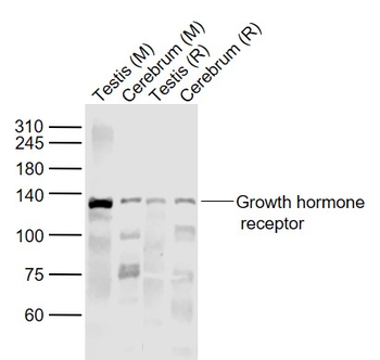 Growth hormone receptor Rabbit Polyclonal Antibody