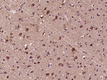 GLI1 Rabbit Polyclonal Antibody