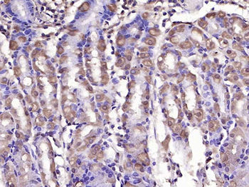 GLI1 Rabbit Polyclonal Antibody