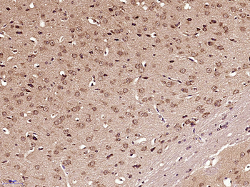 GLI1 Rabbit Polyclonal Antibody