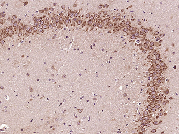 GLI1 Rabbit Polyclonal Antibody