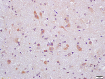 GLP-1 Rabbit Polyclonal Antibody
