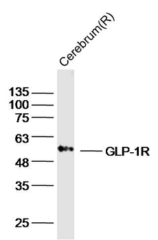 GLP-1R Rabbit Polyclonal Antibody