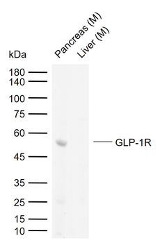 GLP-1R Rabbit Polyclonal Antibody