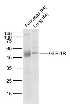 GLP-1R Rabbit Polyclonal Antibody