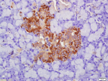 GLUT2 Rabbit Polyclonal Antibody