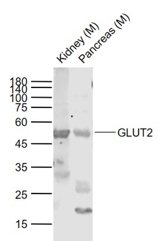 GLUT2 Rabbit Polyclonal Antibody