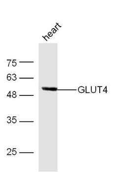 GLUT4 Rabbit Polyclonal Antibody