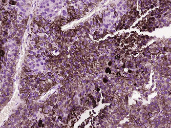 GM-CSFR alpha Rabbit Polyclonal Antibody