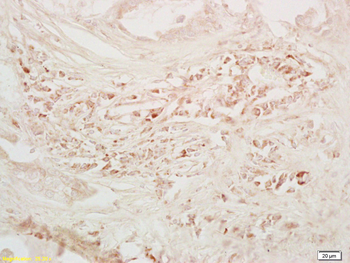 GM-CSFR alpha Rabbit Polyclonal Antibody