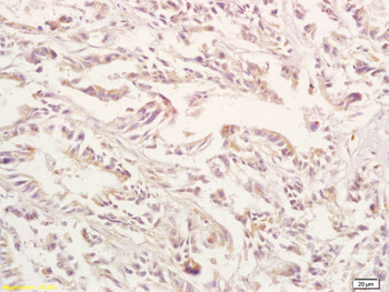 GPA33 Rabbit Polyclonal Antibody