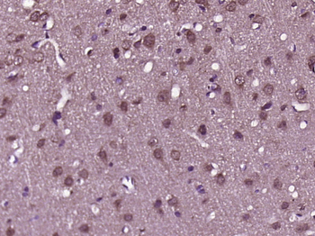 GRB2 Rabbit Polyclonal Antibody