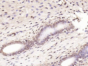 GPR30 Rabbit Polyclonal Antibody