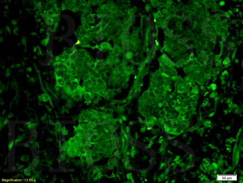 GPR30 Rabbit Polyclonal Antibody