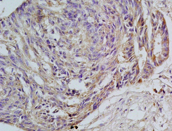 GPR30 Rabbit Polyclonal Antibody