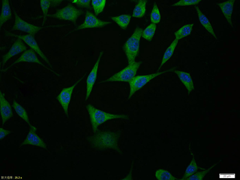 GPR30 Rabbit Polyclonal Antibody