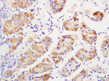 GRK2 Rabbit Polyclonal Antibody