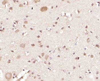 GRP75 Rabbit Polyclonal Antibody