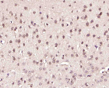 GRP75 Rabbit Polyclonal Antibody