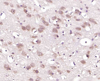 GRP75 Rabbit Polyclonal Antibody