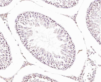 GRP75 Rabbit Polyclonal Antibody