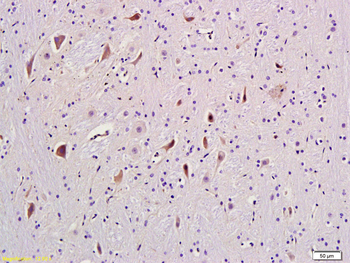 MGluR5 Rabbit Polyclonal Antibody