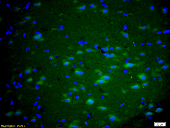 MGluR5 Rabbit Polyclonal Antibody