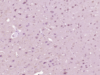 CTNND1 Rabbit Polyclonal Antibody